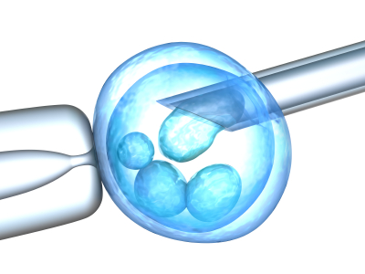 infertility center discusses frozen or fresh embryos