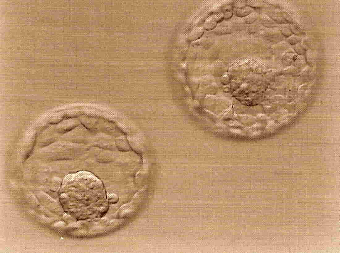 embryo grading helps with treatment