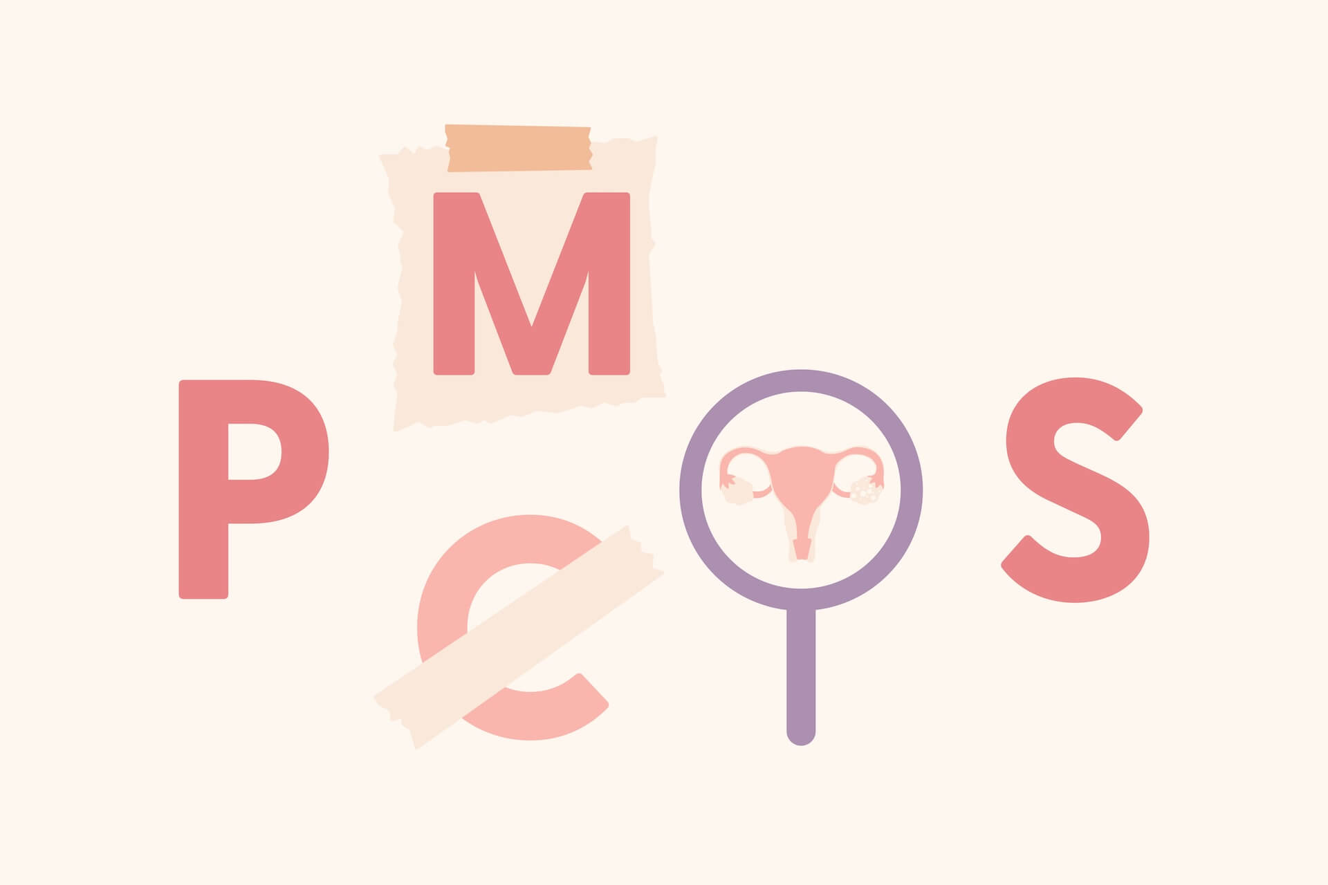 Illustration showing PCOS renamed to PMOS, representing the new official name polyendocrine metabolic ovarian syndrome